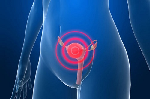 Fattori di rischio di un cancro all’utero Fattori di rischio di un cancro all’utero