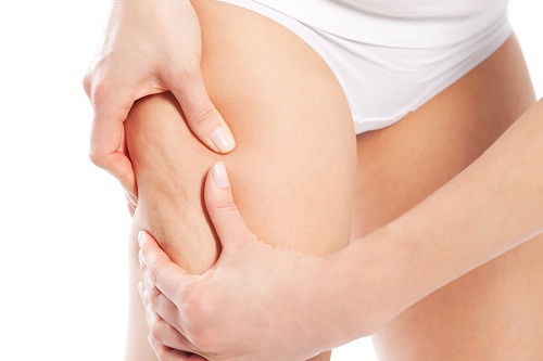 cellulite4