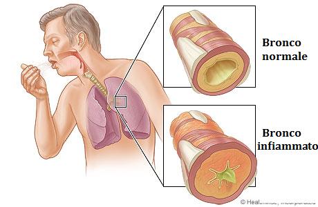 Bronchi