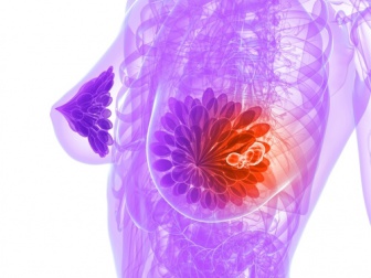 9 alimenti che aiutano a prevenire il cancro al seno