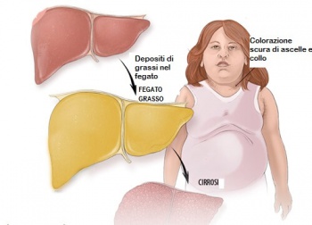 Frutta adeguata per trattare il fegato grasso