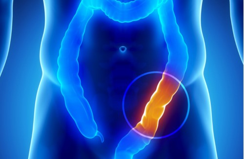 8 cose da sapere sul colon