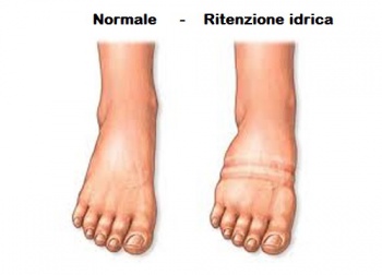 Come combattere la ritenzione idrica