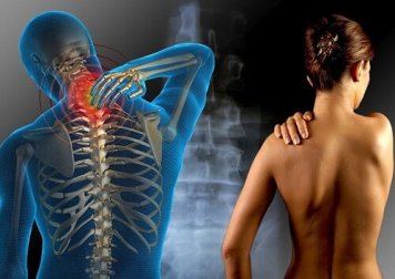 Erbe per il trattamento della fibromialgia