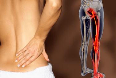 Infusi e consigli per trattare la sciatica