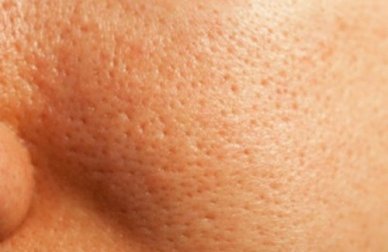 Come chiudere i pori in modo naturale