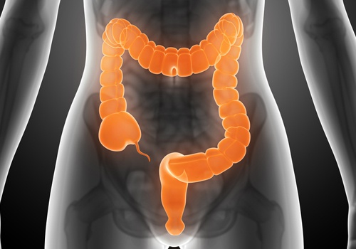 Colon-irritabile