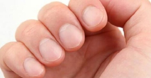 Le unghie rivelano lo stato di salute