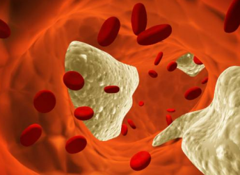 7 miti che dovreste conoscere sul colesterolo