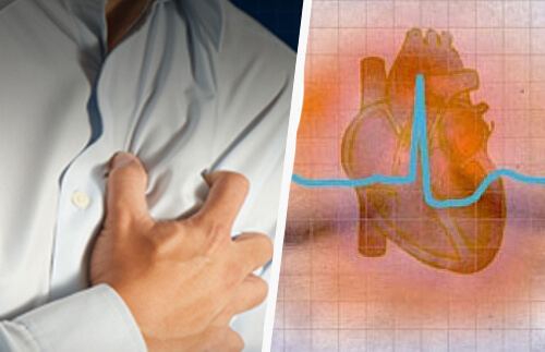 Aritmia cardiaca: sintomi e conseguenze