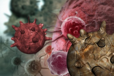 Cancro