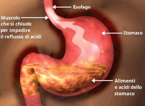 Stomaco con alimenti acidi