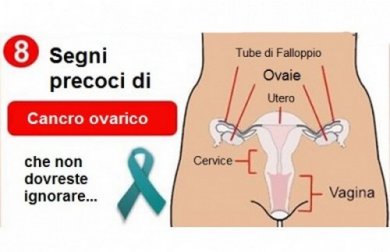8 segni precoci di un cancro dell'ovaio da non ignorare