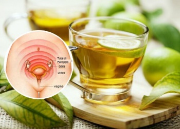 Le coliche mestruali: cosa sono e come calmarle