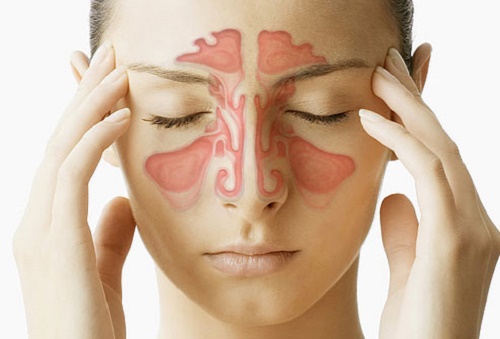 Congestione nasale e dolore alla tempie