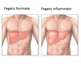 Sintomi del fegato infiammato e dieta adeguata