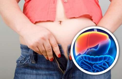 Il gonfiore è uno dei sintomi del fegato infiammato