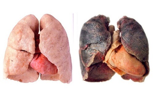 Consigli per avere polmoni più puliti
