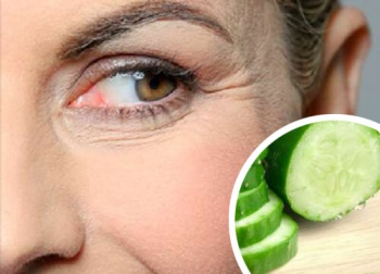 Ridurre le rughe: 9 rimedi naturali e qualche consiglio