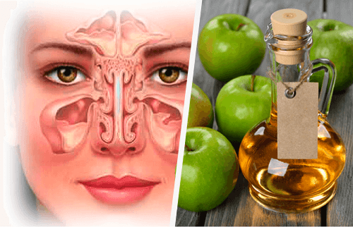 Rimedi fatti in casa per decongestionare i seni paranasali