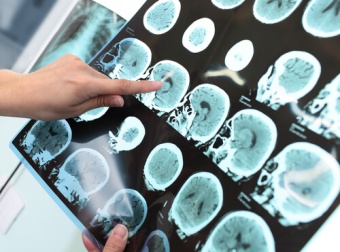 Esami radiologici