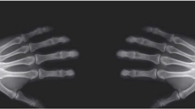 Scrocchiare le dita: cosa succede alle ossa?