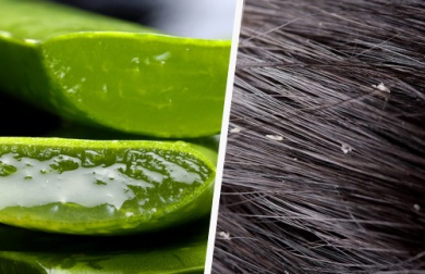 Consigli efficaci per dire addio alla forfora