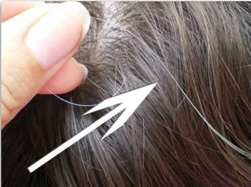 capelli bianchi prematuri
