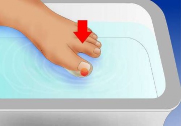 Come trattare il problema delle unghie incarnite