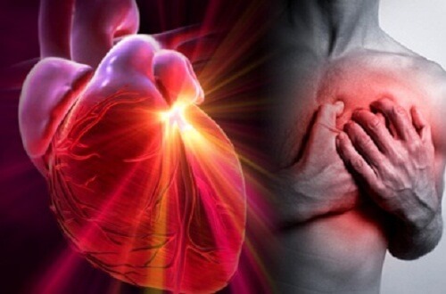 Come riconoscere le differenze tra infarto, arresto cardiaco e ictus Come riconoscere le differenze tra infarto, arresto cardiaco e ictus