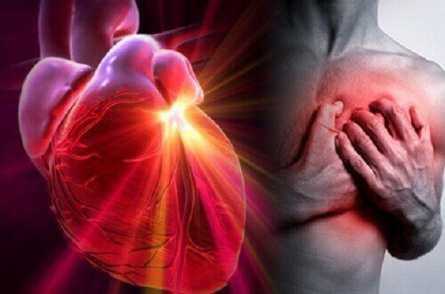 Malattie cardiovascolari: infarto, arresto cardiaco e ictus