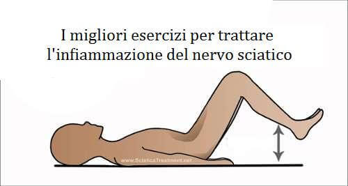 Nervo sciatico infiammato: come alleviarlo