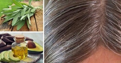 Cause e rimedi naturali per i capelli bianchi