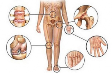 Antinfiammatori di origine naturale per i dolori articolari