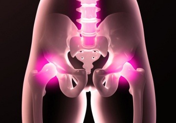 Salute dell'anca e abitudini che la danneggiano