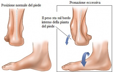 Abitudini che danneggiano i talloni: niente più passi falsi