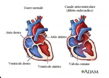7 sintomi che indicano un soffio al cuore