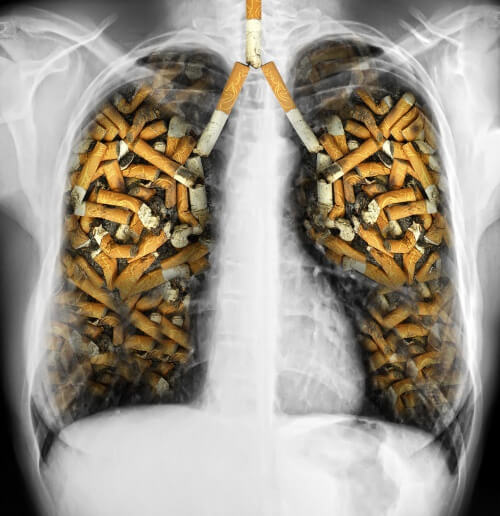 Effetti del fumo sui polmoni