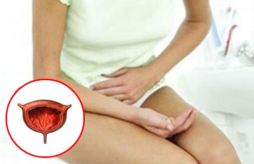 Trattenere la voglia di urinare - Bruciore a urinare