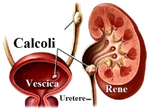 trattenere la voglia di urinare contribuisce alla formazione di calcoli renali