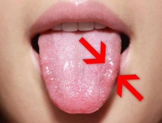 Candidosi: curatela con 9 rimedi naturali
