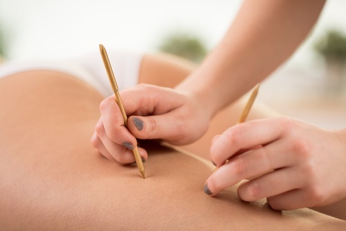 agopuntura-500x334