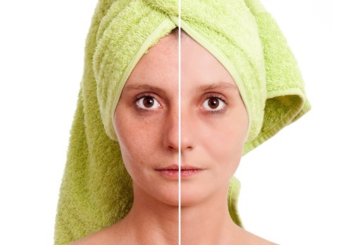 benefici tonico contro imperfezioni pelle