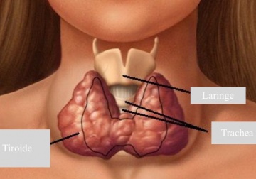 Trattamento naturale dell'ipotiroidismo