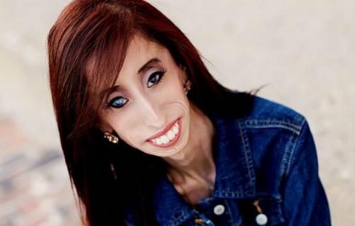 Lizzie Velásquez