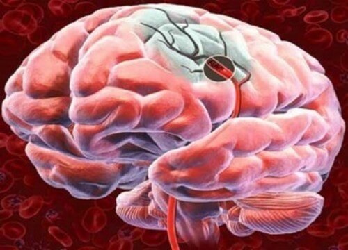 5 modi di migliorare il flusso sanguigno del cervello