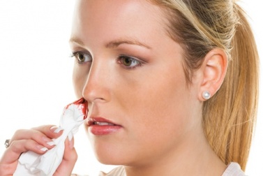 Rimedi naturali per il sangue dal naso