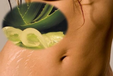 Schiarire le smagliature con 6 rimedi naturali