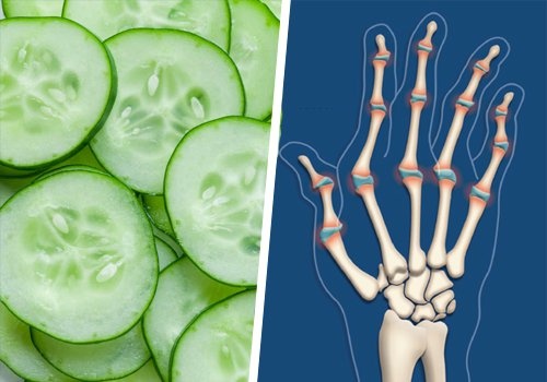Una alimentazione sana aiuta a proteggere le ossa e le articolazioni alleviando il dolore articolare notturno