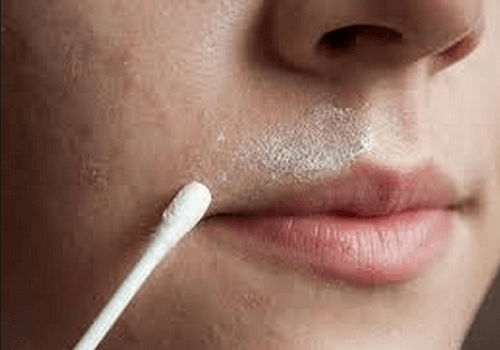 Peli del viso: eliminarli con un rimedio naturale